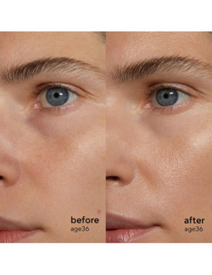 Retinol Alternative Sérum – Anti-âge naturel et sans irritation